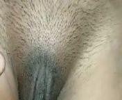 Wife Pet Tummy strech marks panty from indian aunty stretchmarks