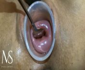 Maya Simons Masturbating her Cervix With a SPOON! from bangla meyeder gopon hot videomature ledy sex 3gp video