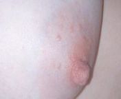 Puffy nipple from pink puffy nipple