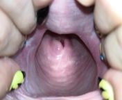 Cervix close up [4k] from 美国阿马里洛约炮【微信：f35k36】 ohca